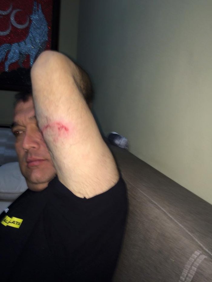 Frenci Ömer’i köpek ısırdı