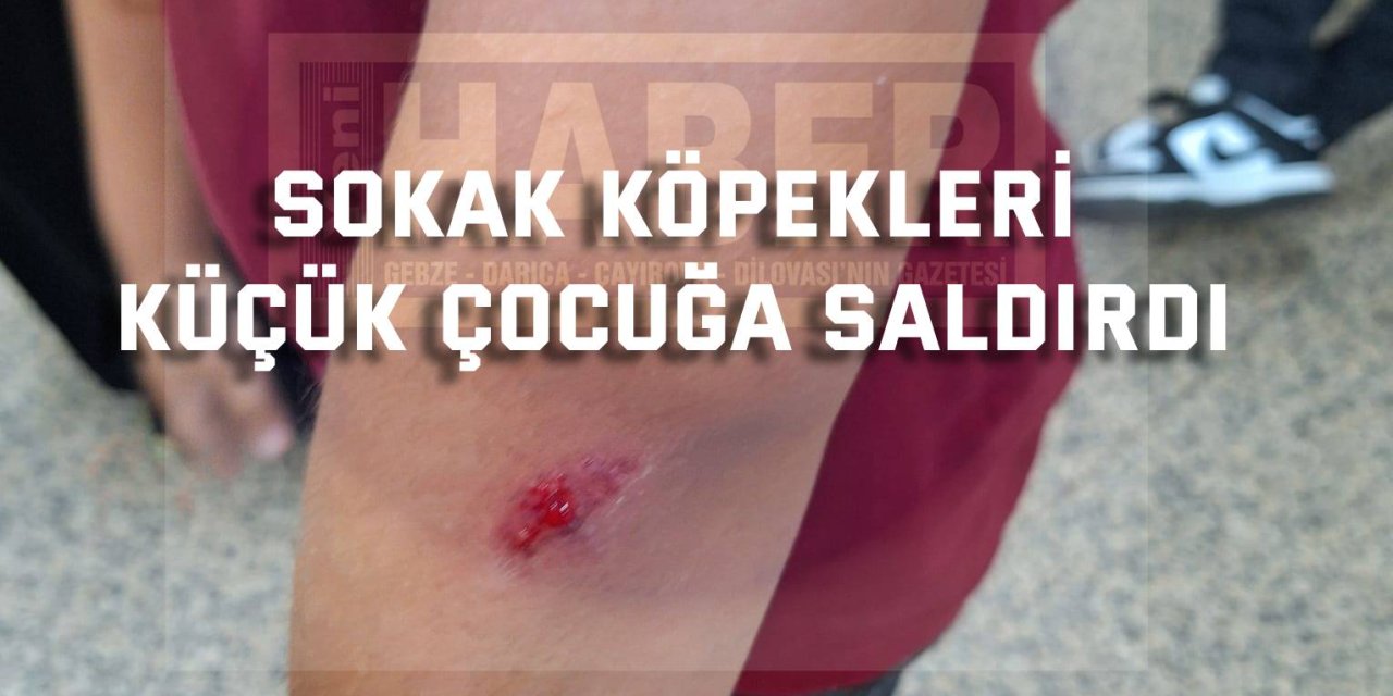 Sokak Köpekleri Küçük Çocuğa Saldırdı