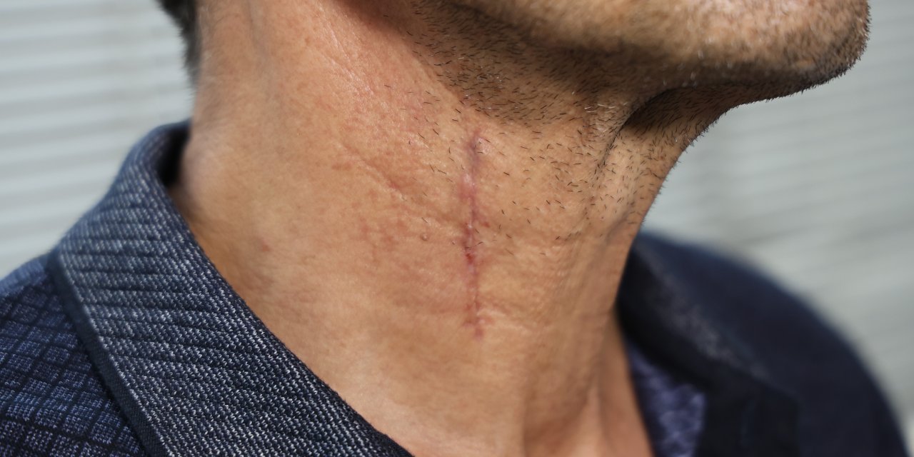 Boyun fıtığı canından ediyordu