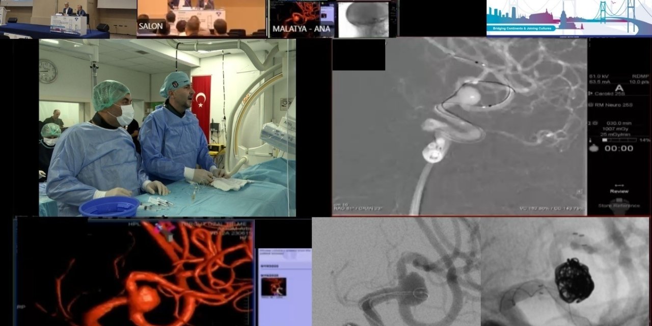 Canlı yayında zorlu beyin ameliyatı
