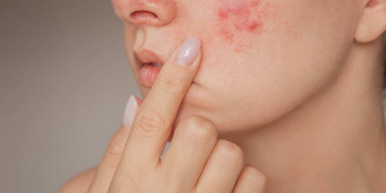 Yüzde Aniden Beliren Kabarıklığa Dikkat!