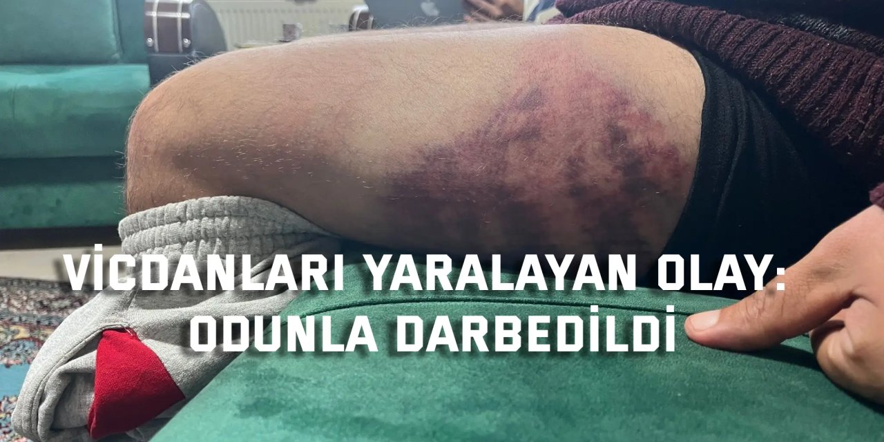 Vicdanları yaralayan olay: Odunla darbedildi