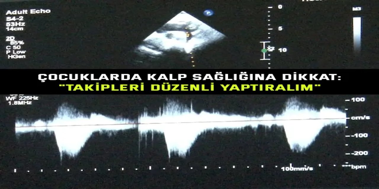ÇOCUKLARDA KALP SAĞLIĞINA DİKKAT:    "Takipleri düzenli yaptıralım"