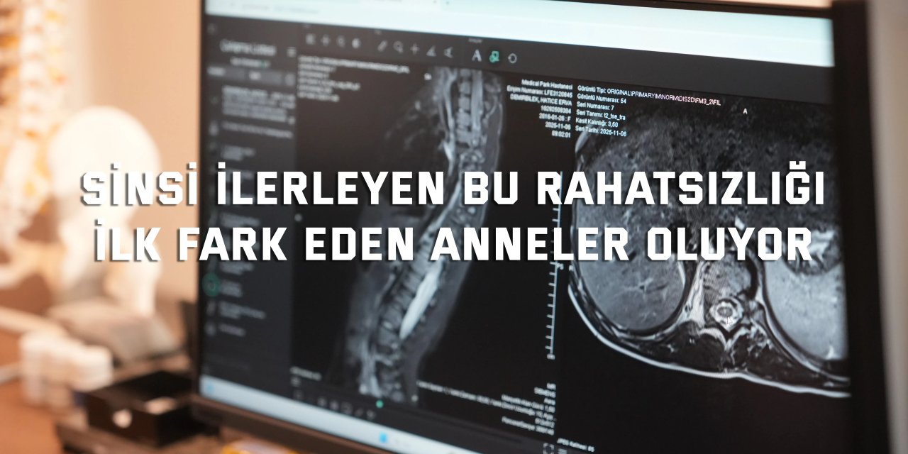 Sinsi ilerleyen bu rahatsızlığı  ilk fark eden anneler oluyor