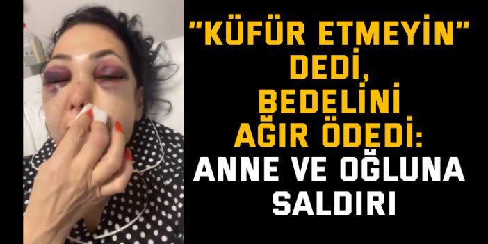 “Küfür etmeyin” dedi, bedelini ağır ödedi: Anne ve oğluna saldırı