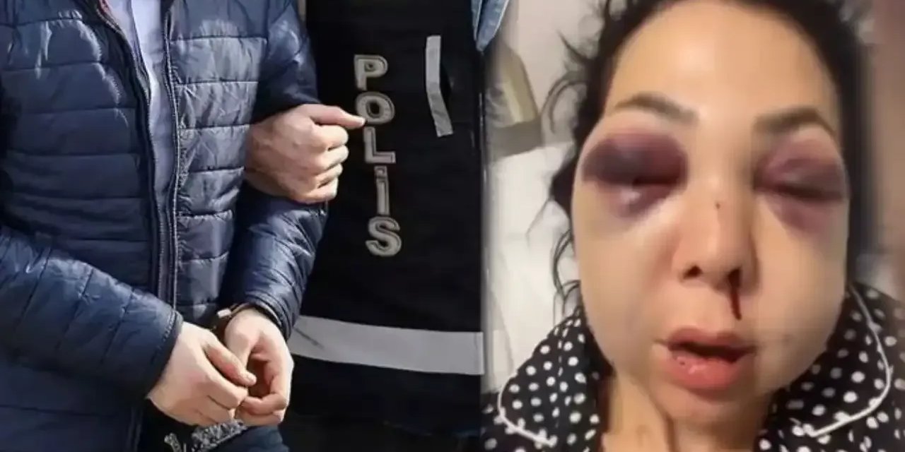 İzmit’te anne ve oğluna saldırıda 1 kişi tutuklandı