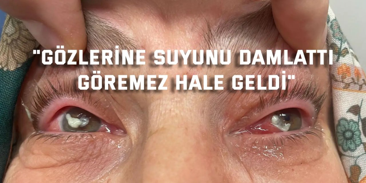"Gözlerine suyunu damlattı, göremez hale geldi"