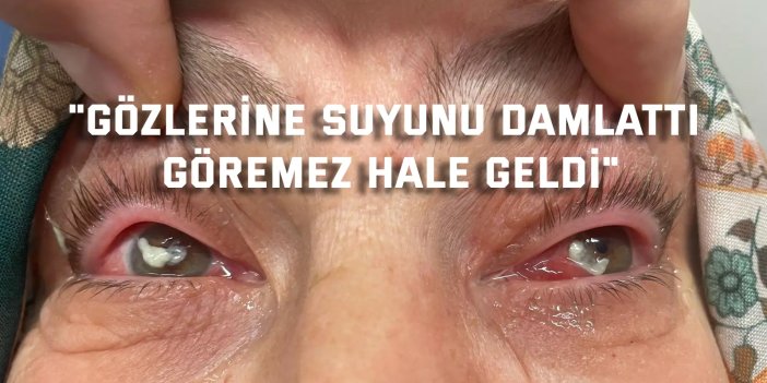 "Gözlerine suyunu damlattı, göremez hale geldi"
