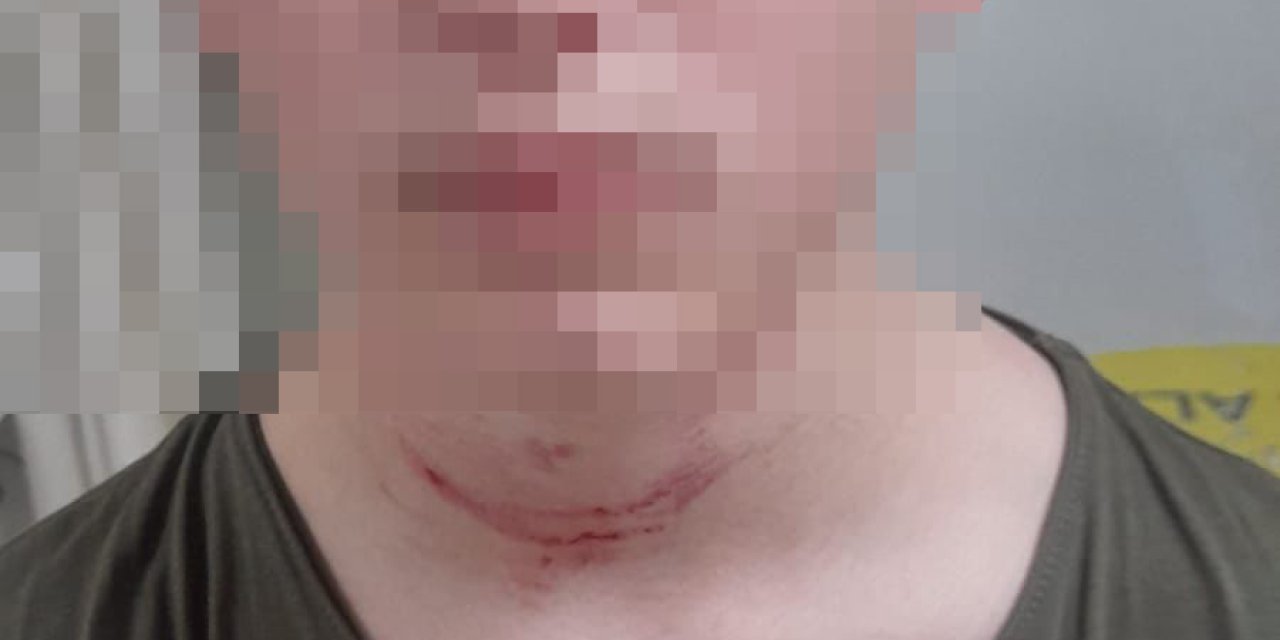 Okulda Akran Zorbalığı İddiası: 8. Sınıf Öğrencisi Darp Edildi