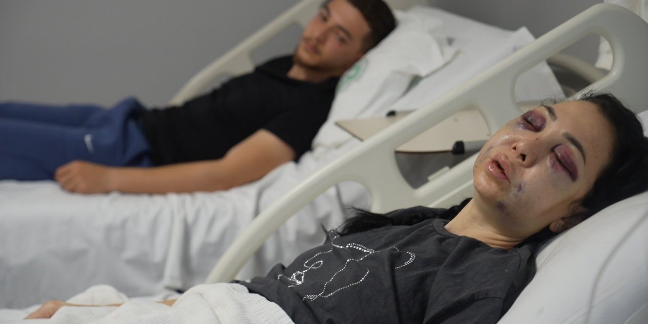 Feci şekilde darp edilmişti, yaşadığı dehşeti unutamıyor