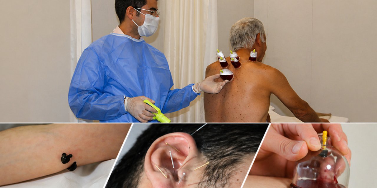 Hacamat, Sülük, Akupunktur… Artık Herkes Yapamayacak! İşte  Yeni Kurallar