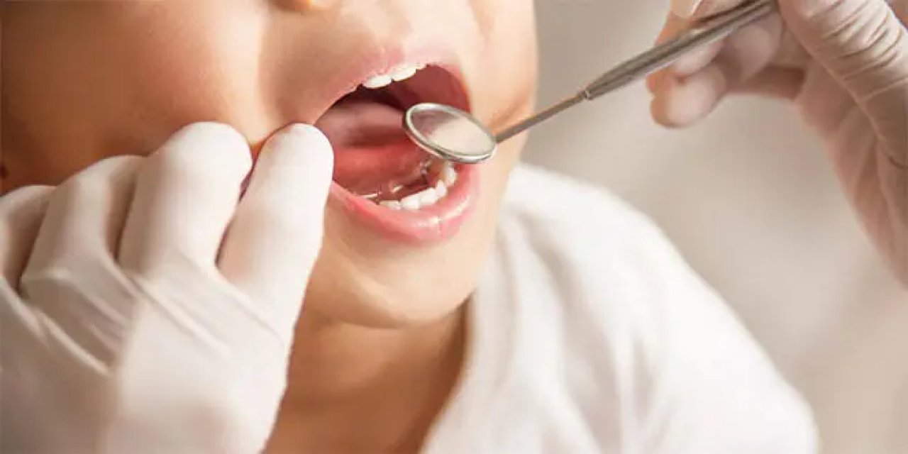 Yaz Tatilinde Çocuklarda   Diş Çürüğü Riski Artıyor
