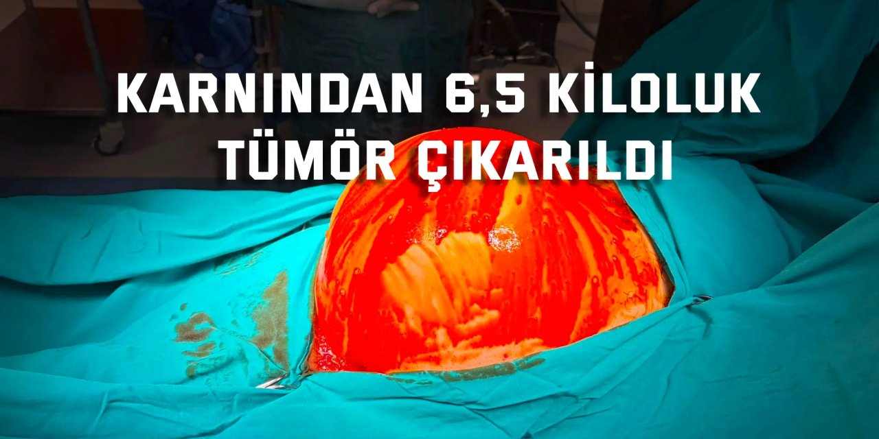 Karnından 6,5 kiloluk tümör çıkarıldı