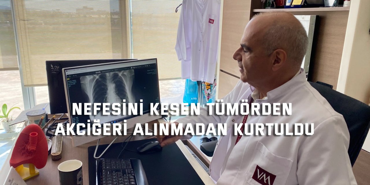 Nefesini kesen tümörden akciğeri alınmadan kurtuldu