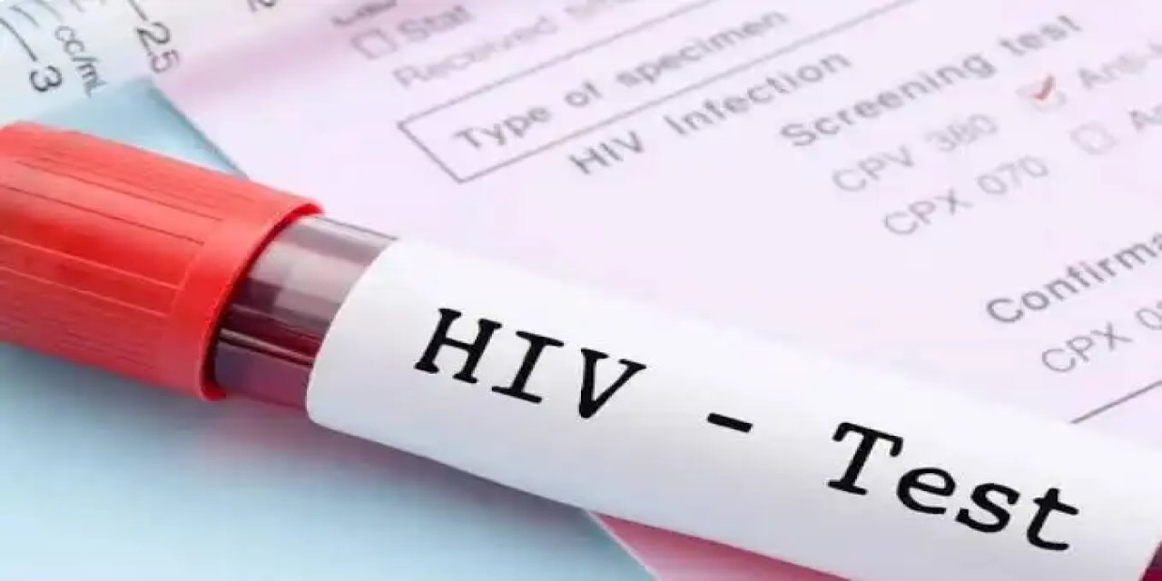 ANONİM VE ÜCRETSİZ    Kocaeli'de HIV Testi Hizmeti Başladı!