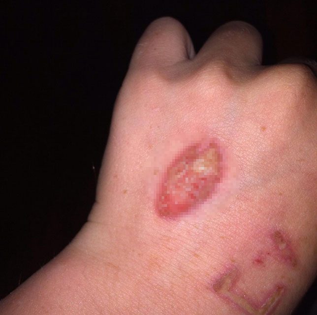 VELİLER DİKKAT! Okula giden tüm çocuklarda görünmeye başlandı!