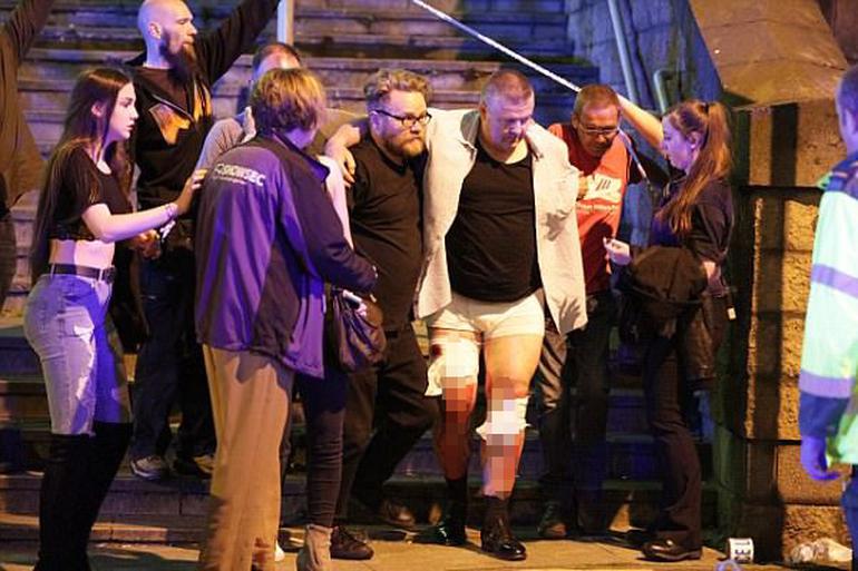  İngiltere'nin Manchester şehrinde patlama: 19 ölü, 59 yaralı