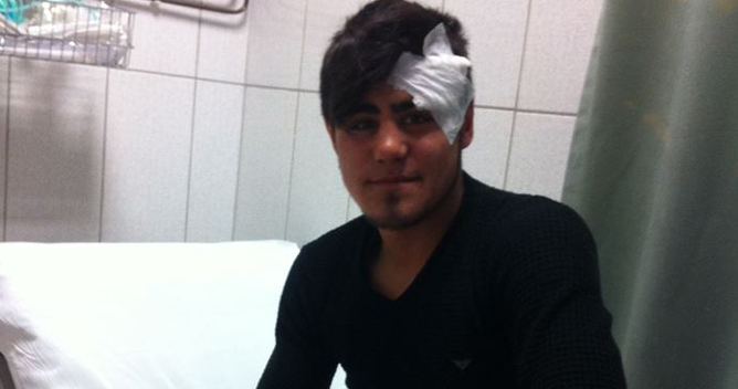 Sokak köpekleri bir kişiye daha saldırdı