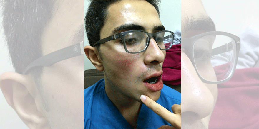 Sağlık çalışanına yumruklu saldırı