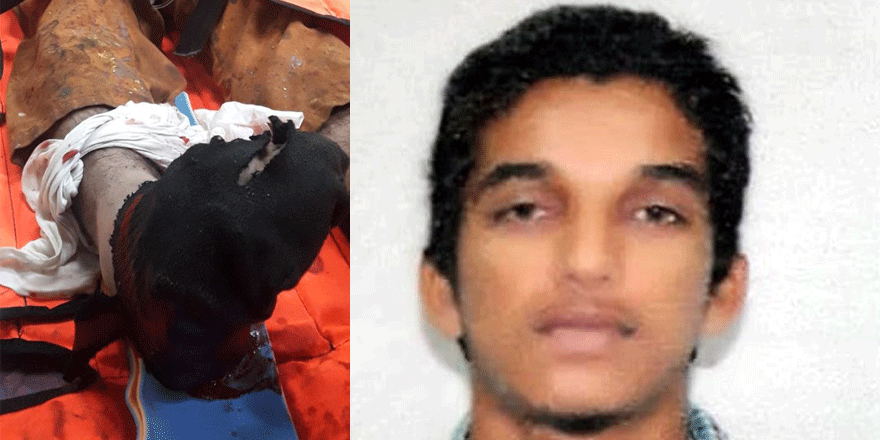 Mısırlı işçi yaralandı