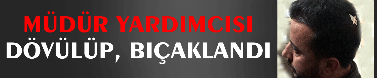 Müdür yardımcısı dövülüp, bıçaklandı