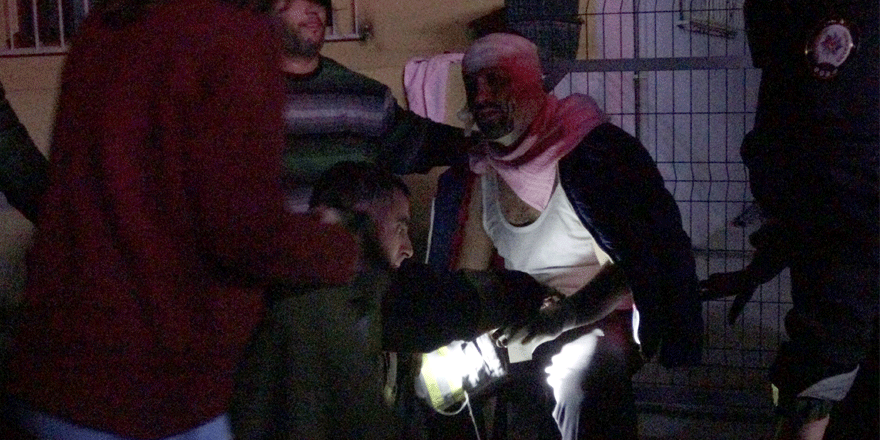 Yangını söndürmek isterken yaralandı