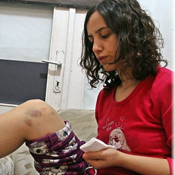 Berkin’i anarken bu hale geldi