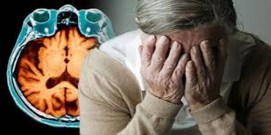 ALZHEIMER’DAN KORUMAK VE KORUNMAK 9 İÇİN ÖNERİ