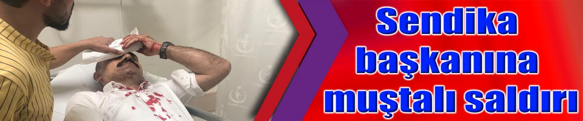 Sendika başkanına muştalı saldırı
