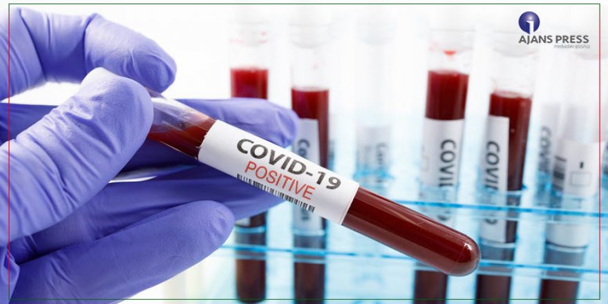 Koronavirüs Hakkında 10 Milyona Yakın Haber Çıktı