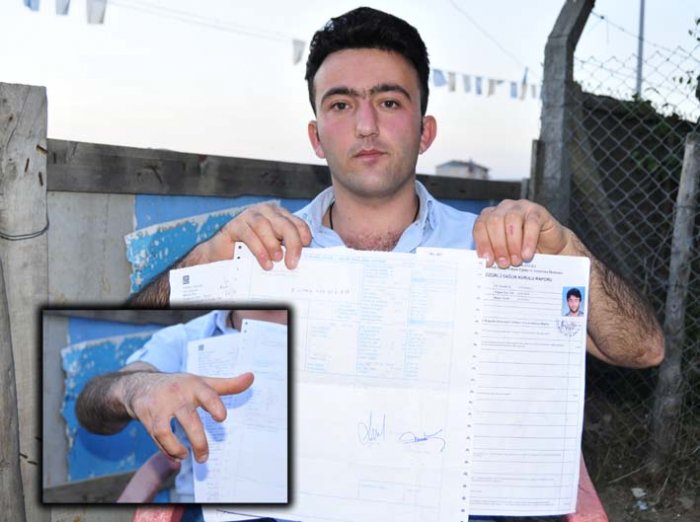 Hayatını altüst eden kaza