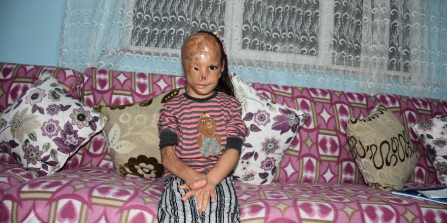 5 yaşındaki Dilara yardım bekliyor