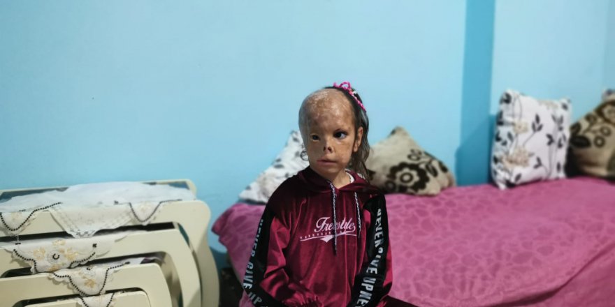 Dilara Akdeniz Üniversitesi’nde tedavi olacak