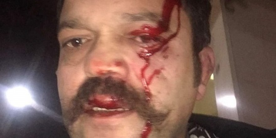 Feci şekilde darp edildi!