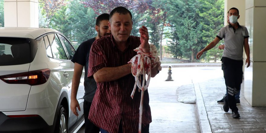 "Acemi kasaplar" hastanelik oldu