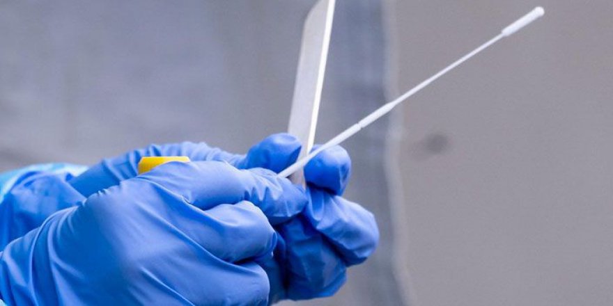 Aşı olmayan işçiye PCR şartı