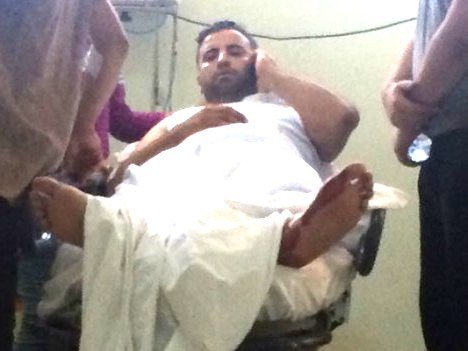 Dayak yedi, arkadaşını çağırdı, o da vuruldu