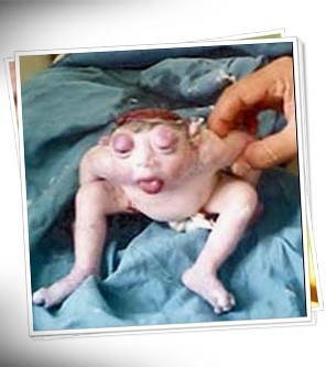 Kurbağa Bebek Görenleri Hayrete Düşürdü!