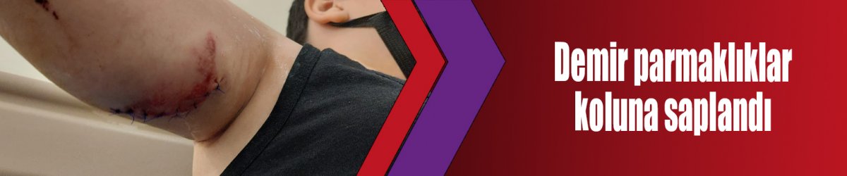 Demir parmaklıklar koluna saplandı